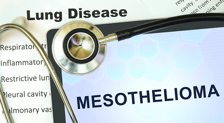 Mesothelioma diagnosis on doctor's clipboard
